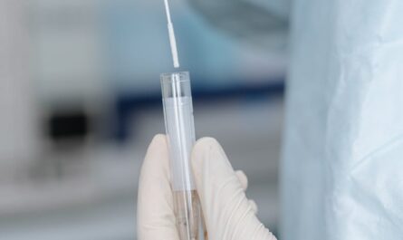 Test PCR na krztusiec