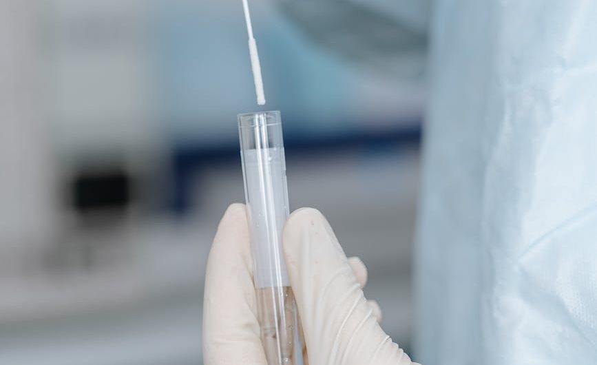 Test PCR na krztusiec