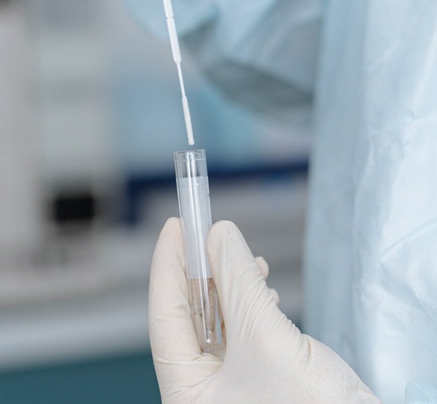 Test PCR na krztusiec