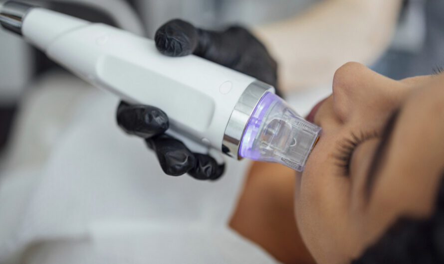 Na co pomaga radiofrekwencja mikroigłowa?